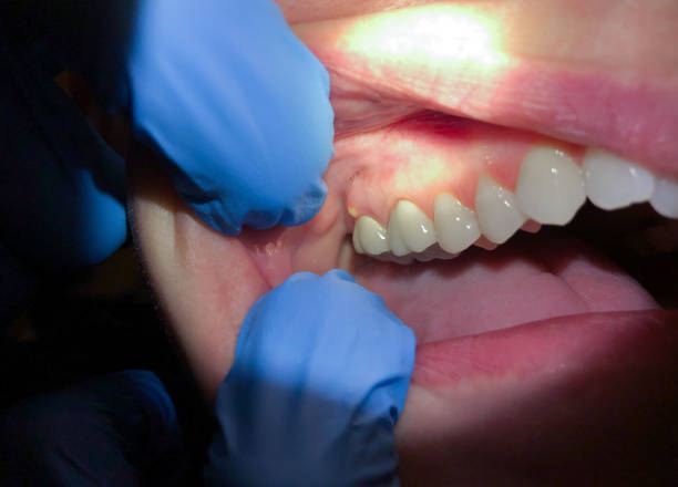 Best Walk-In Emergency Dentist in Morrisonvle, IL